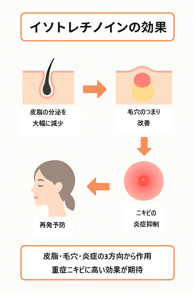 イソトレチノイン